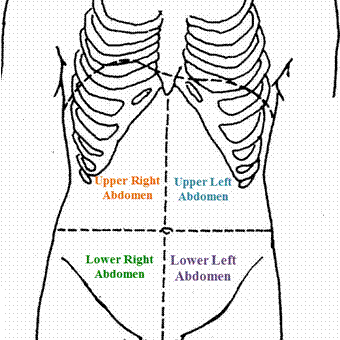 the partition of abdominal pain:upper left abdomen, upper right abdomen, lower left abdomen, lower right abdomen