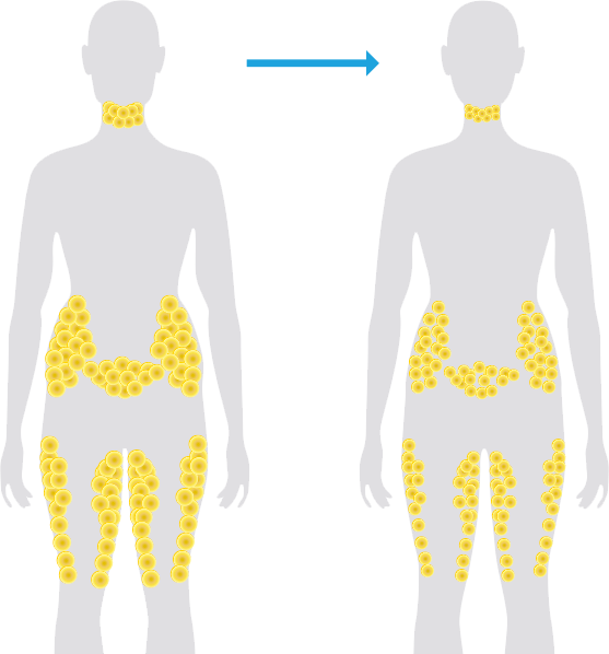 When You Loose Weight Where Does The Fat Go