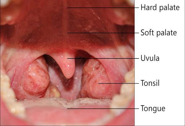 Throat Cancer Symptoms