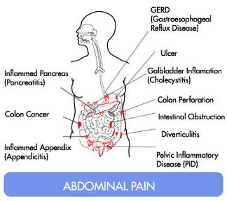 pain abdominal stomach causes upper side right lower symptoms left rib cage under gas code ribs chest burning nausea icd